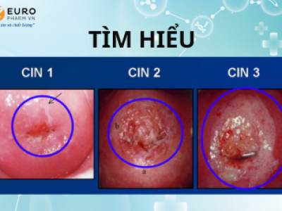 Thế nào là CIN 1,2,3 