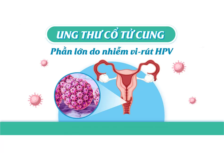 ung thư cổ tử cung do HPV