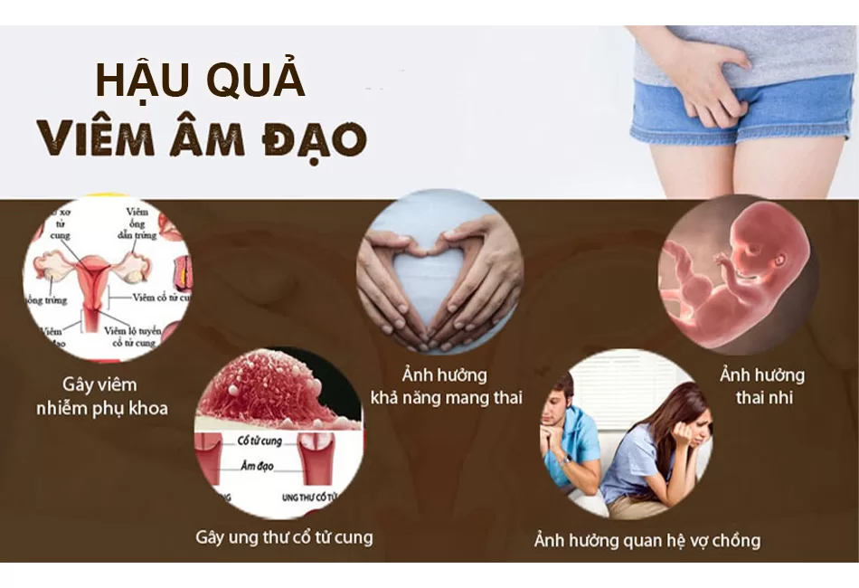 hậu quả viêm âm đạo