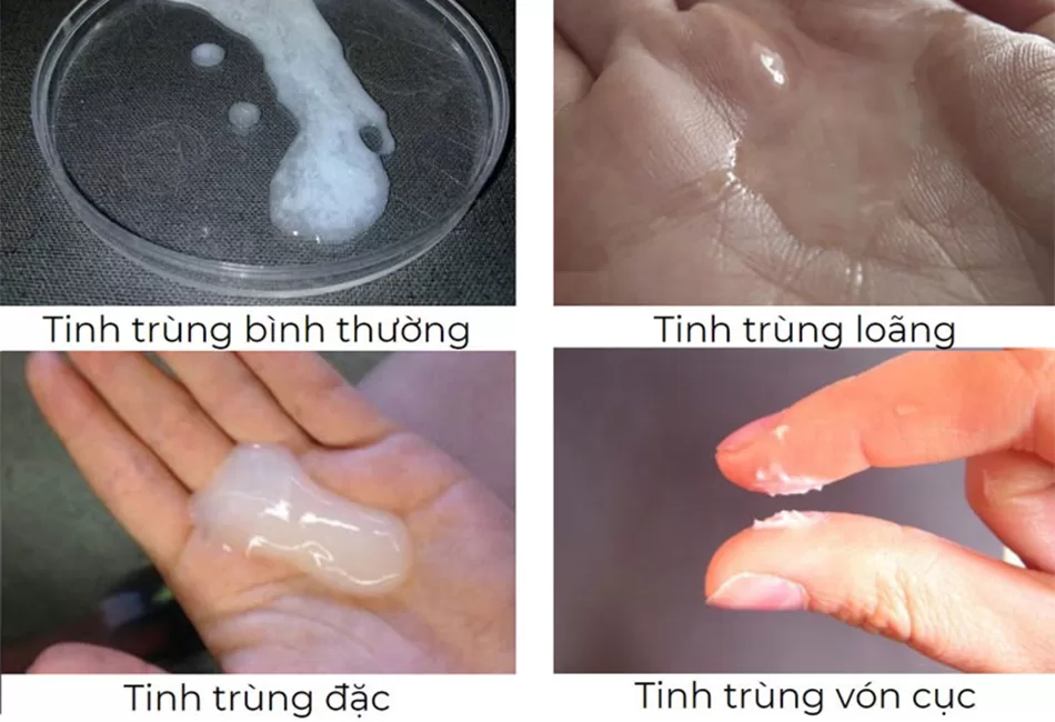 cách kiểm tra tinh trùng mạnh hay yếu ngay tại nhà