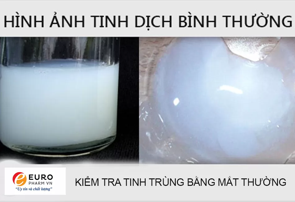 cách kiểm tra tinh trùng mạnh hay yếu ngay tại nhà