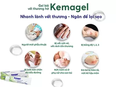 Kemagel là thuốc gì?