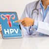 Top 6 Sản phẩm tăng đào thải virus HPV tốt nhất