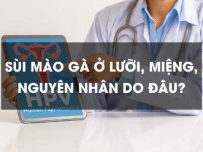 Sùi mào gà ở lưỡi, miệng, nguyên nhân do đâu?