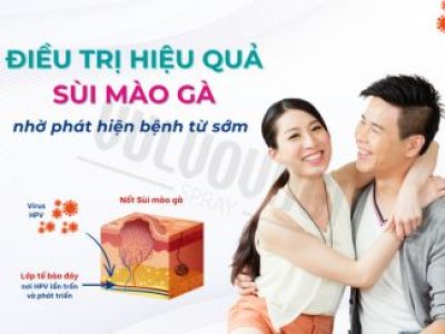 Cách xử lý sùi mào gà nhanh rụng, ngừa tái nhiễm