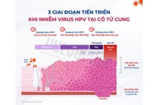 Đào thải HPV