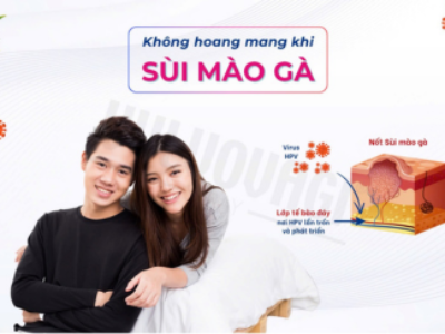 Cập nhật mới nhất cách xử trí sùi mào gà cho cả nam và nữ