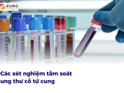 Các xét nghiệm tầm soát ung thư cổ tử cung: Cách bảo vệ sức khỏe phụ nữ hiệu quả