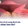 Ung thư cổ tử cung đã di căn sống được bao lâu?