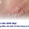 Những điều cần biết về khả năng tự khỏi của mụn cóc sinh dục