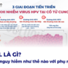 HSIL là gì? HSIL nguy hiểm như thế nào với phụ nữ?