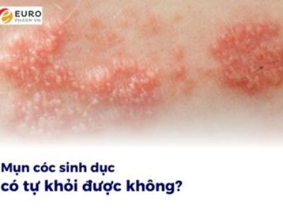 Mụn cóc sinh dục có tự khỏi được không?