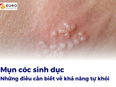 Những điều cần biết về khả năng tự khỏi của mụn cóc sinh dục