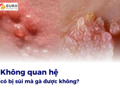 Không quan hệ có bị sùi mào gà được không?