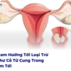 Việt Nam Hướng Tới Loại Trừ Ung Thư Cổ Tử Cung Trong 30 Năm Tới