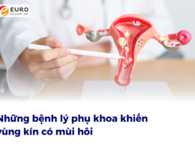 Những bệnh lý phụ khoa khiến vùng kín có mùi hôi