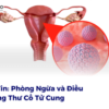 Bản Tin: Phòng Ngừa và Điều Trị Ung Thư Cổ Tử Cung