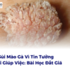 Mắc Sùi Mào Gà Vì Tin Tưởng Người Giúp Việc: Bài Học Đắt Giá