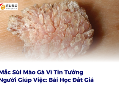 Mắc Sùi Mào Gà Vì Tin Tưởng Người Giúp Việc: Bài Học Đắt Giá