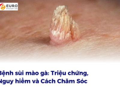 Bệnh sùi mào gà: Triệu chứng, Nguy hiểm và Cách Chăm Sóc