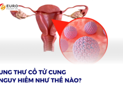 UNG THƯ CỔ TỬ CUNG NGUY HIỂM NHƯ THẾ NÀO?