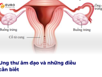 Ung thư âm đạo là gì?