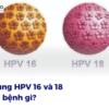 Chủng HPV 16 và 18 gây bệnh gì?