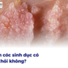 Mụn cóc sinh dục có tự khỏi không?